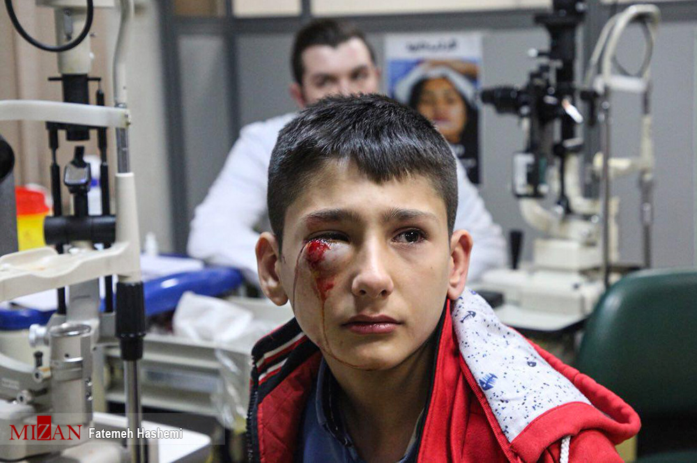 آسیب‌ های چشمی در چهارشنبه سوری