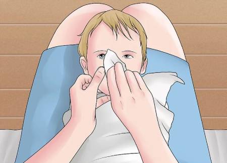 ریختن قطره در چشم نوزادان