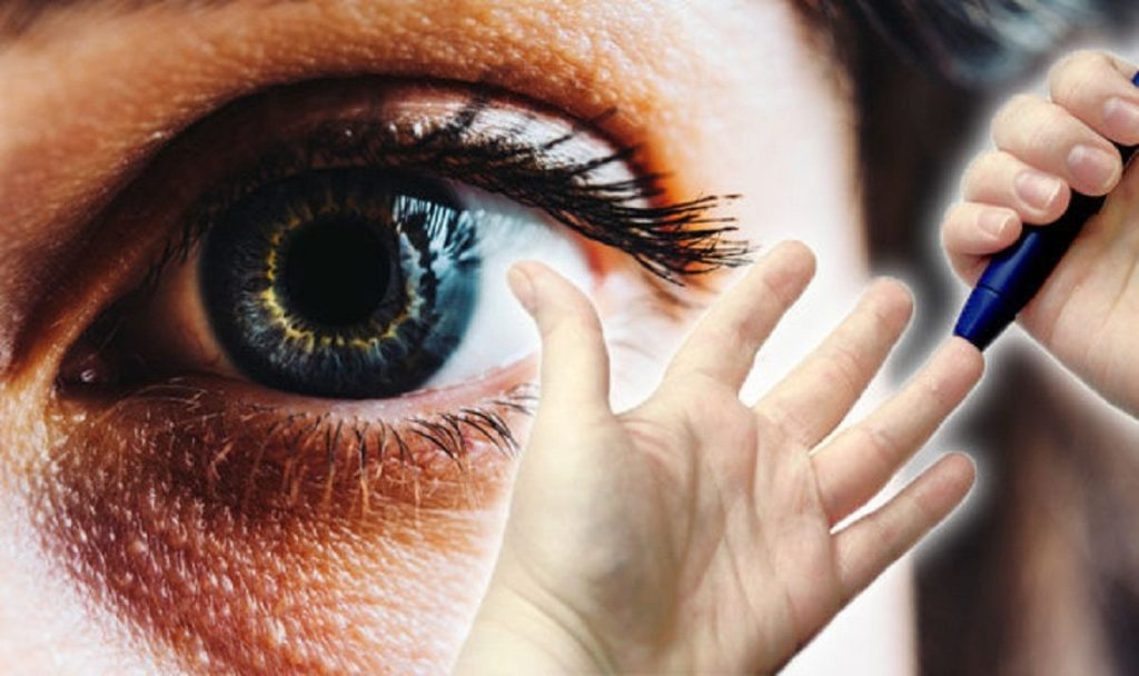 تشخیص بیماری از چشم